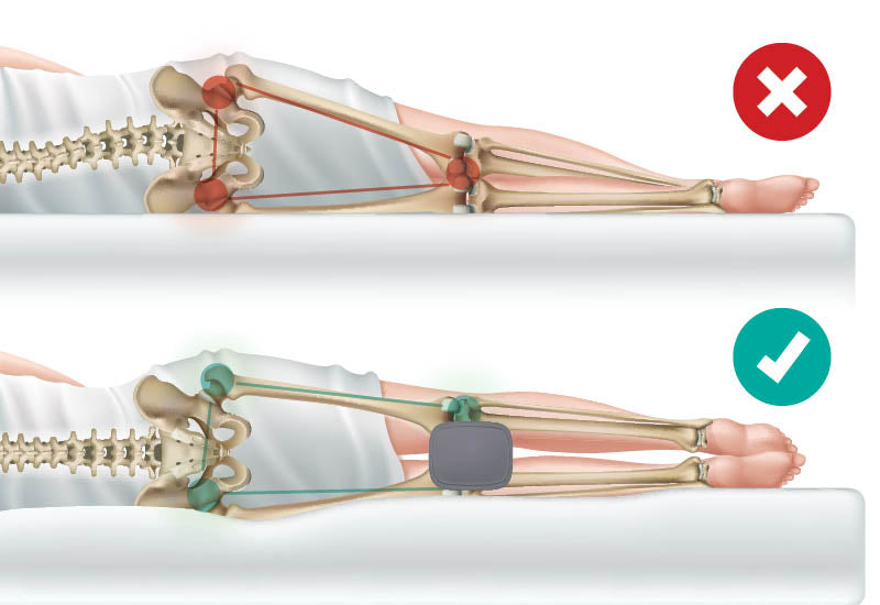 Pernă ergonomică ce ajută la menținerea unei alinieri corecte a corpului.